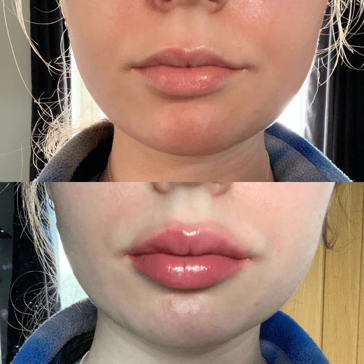 Plump It! No Needles Lip Boosting Trio